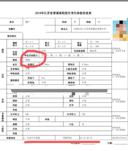 高考体检眼弱视需要复查吗,高三体检弱视能过关吗