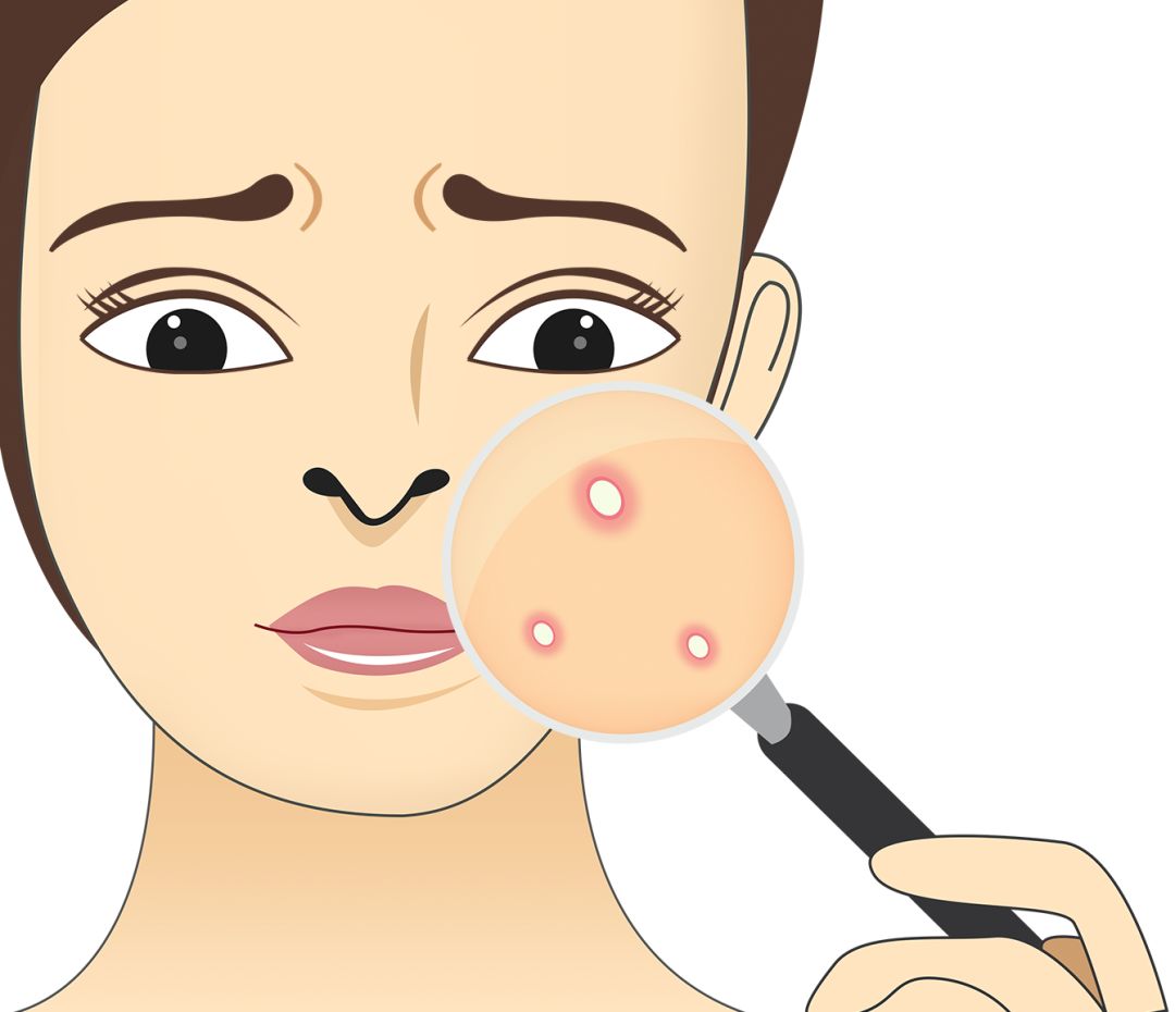 浑身长刺是什么病,健康有什么表现