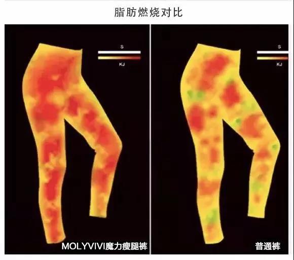 明星瘦腿方法让腿变又细又直,娱乐圈腿精女星