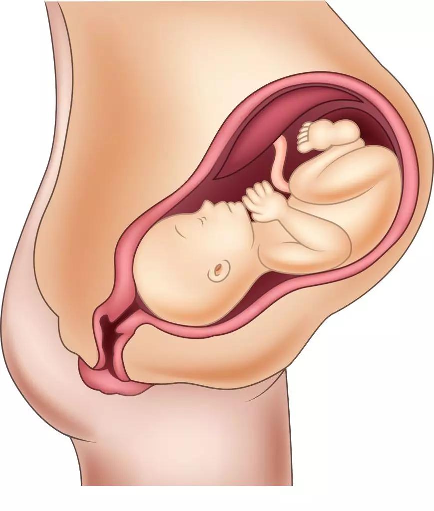 孕期耻骨痛要怎么缓解,孕期耻骨痛得很严重怎么缓解