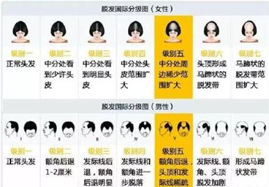阿里扎心年终奖：价值“三万八”的植发钱公司掏，这波不亏