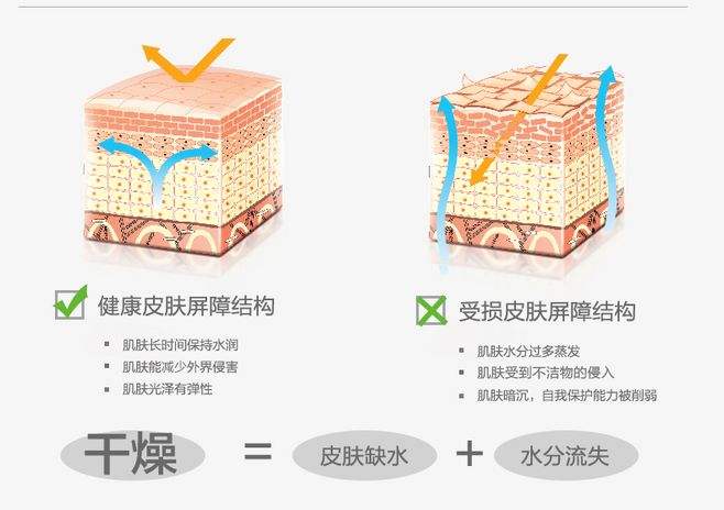 皮肤干燥怎么改善,皮肤干燥发痒怎么改善