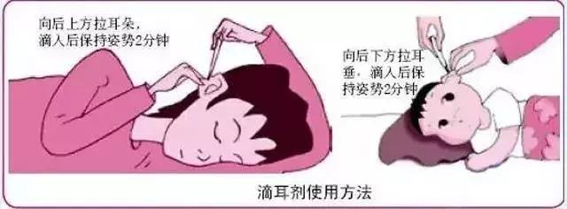 空乘人员得了航空性中耳炎咋办,女子感冒后坐飞机得航空性中耳炎