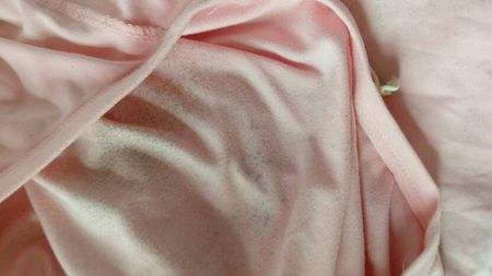 白色衣服发霉怎么洗掉霉斑小妙招,衣服放久了发霉了怎么处理