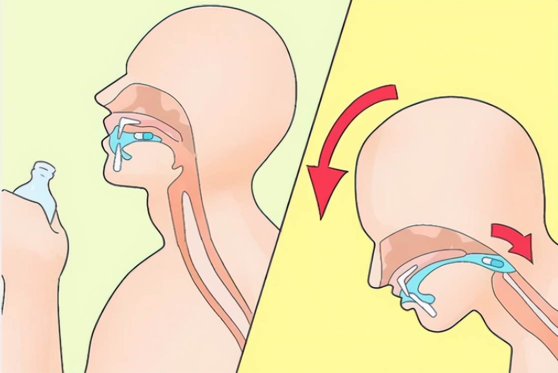 实话石说|胶囊药可以掰开吃吗