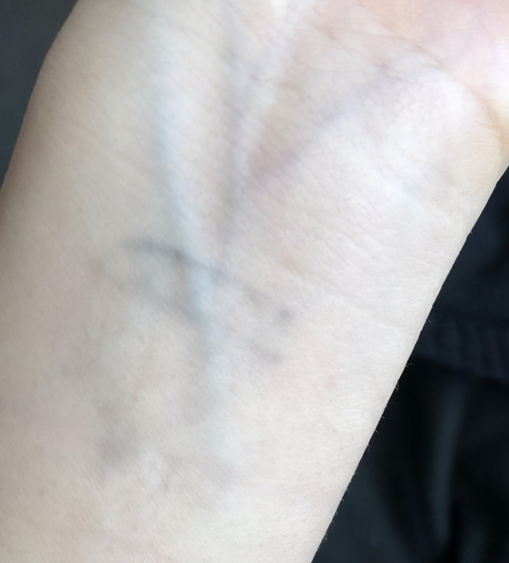 自己洗纹身最好的方法不留疤,洗纹身最好的方法不留疤多少钱