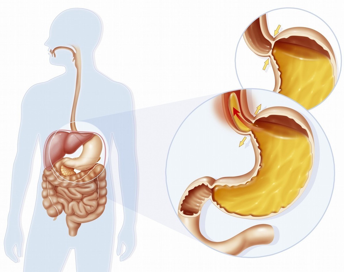 长期咳嗽总不好，有7个常见的原因，找到病因才能有效止咳