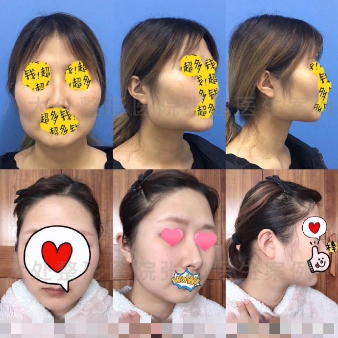 八大处张超抖音,八大处张超合集