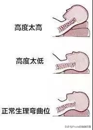 女人脖子后面的富贵包是什么原因,脖子后面有富贵包怎么让它消除