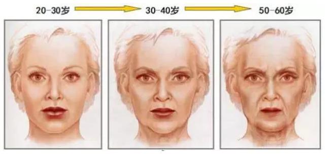 脸松弛除了拉皮和线雕有没有别的,脸颊松弛筋膜提升是线雕还是拉皮