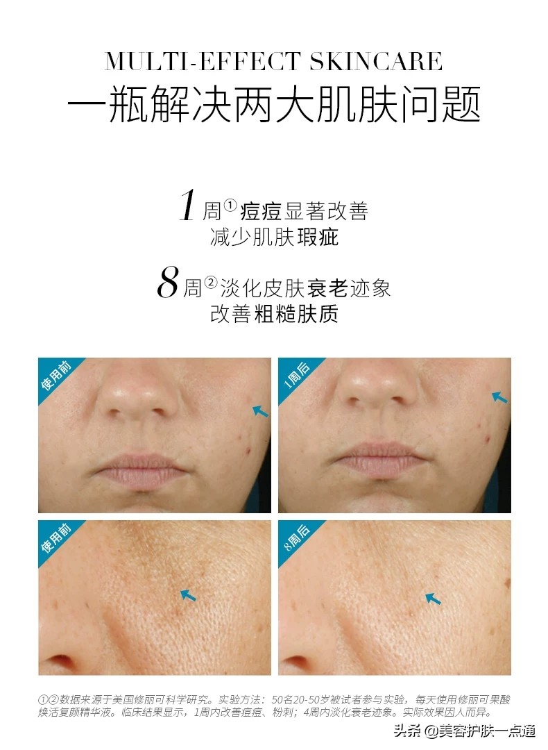 修丽可果酸是哪一款,修丽可果酸使用方法