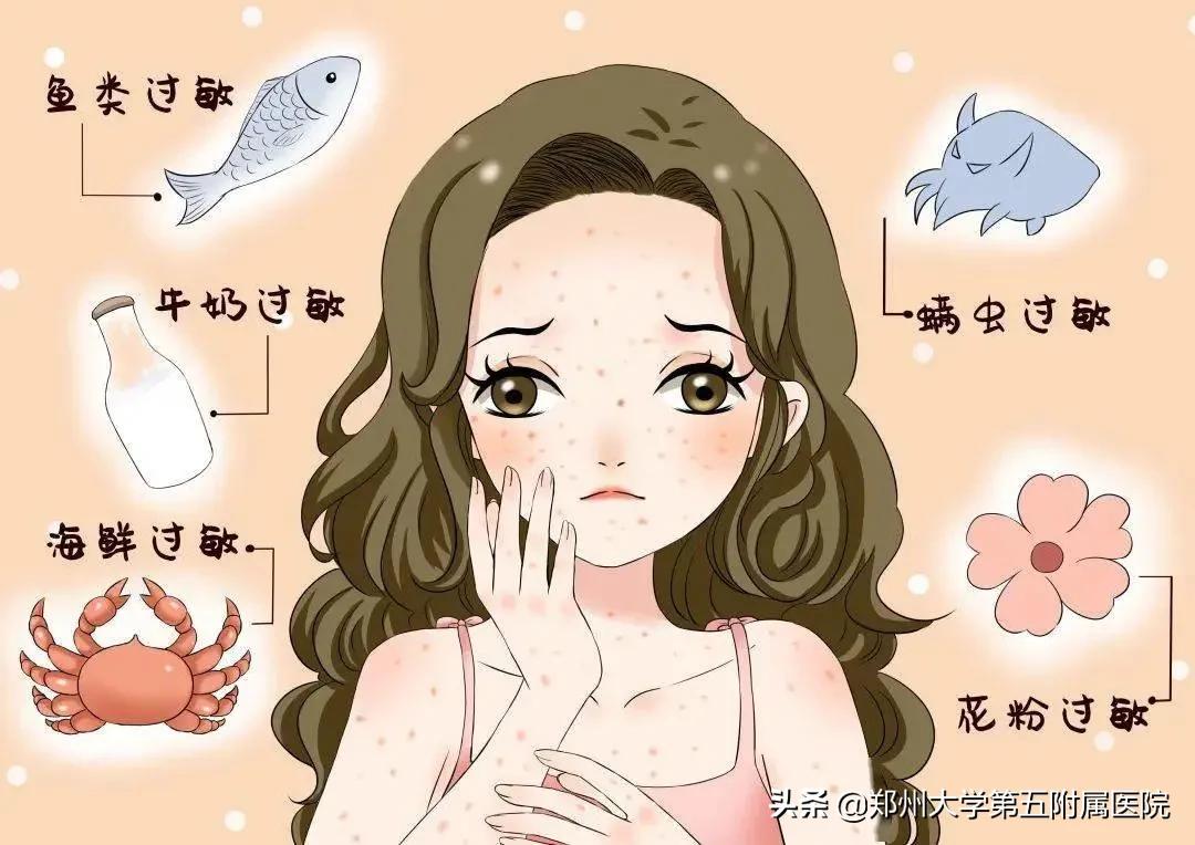 风疙瘩解决办法,风疙瘩的症状和图片