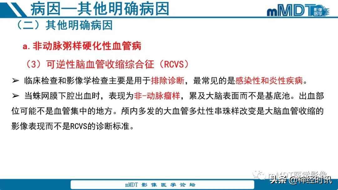急性缺血性脑卒中ppt素材图片,青年缺血性脑卒中ppt