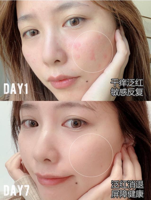 长期使用美容仪斑会淡吗,长期使用美容仪皮肤会提亮吗