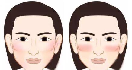 人中长颧骨高适合什么发型,人中长太阳穴凹陷