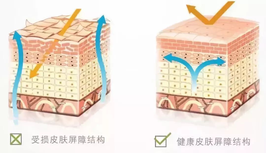 女明星皮肤过敏,女明星过敏发作