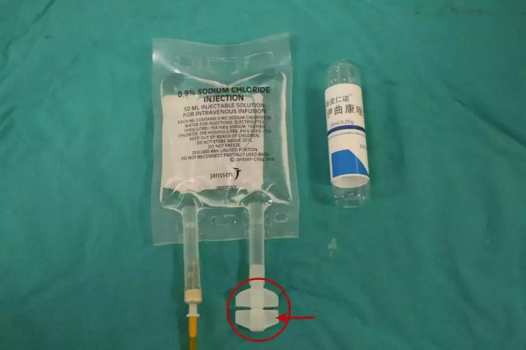 picc堵管了直接拔掉可以吗,化疗用的picc管堵了什么原因