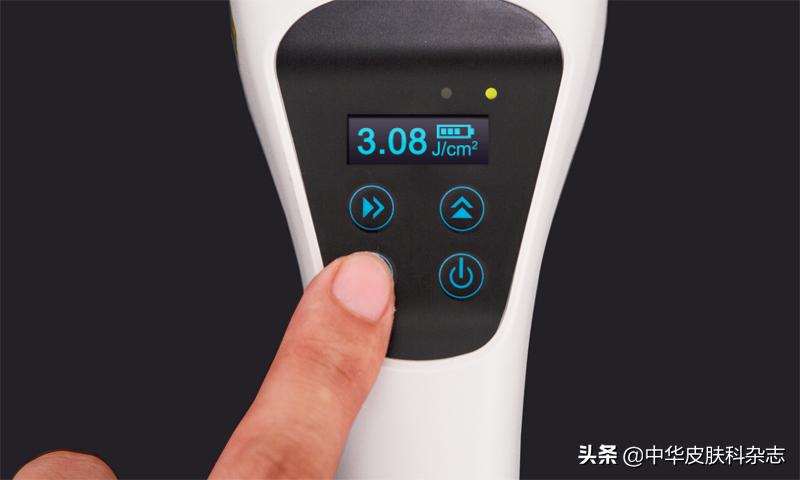 308激光治疗白癜风医保报销吗,308激光治疗银屑病