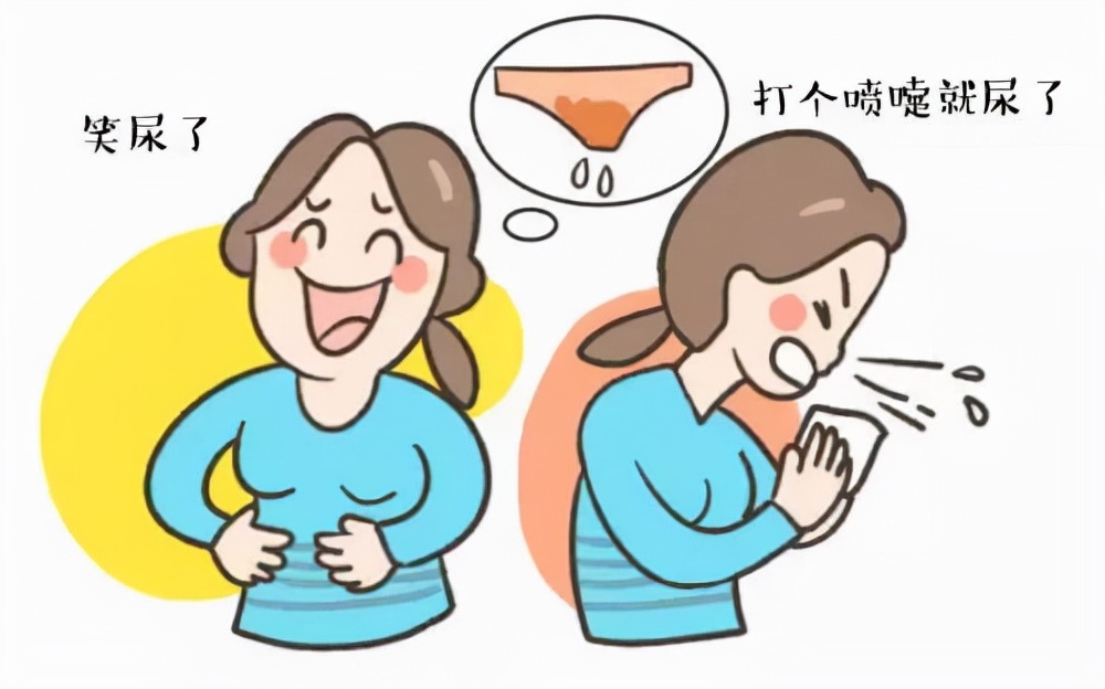 女的咳嗽漏尿是什么原因,咳嗽就漏尿坚持两个动作