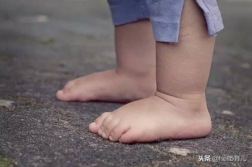 我的宝宝还小，怎么就被脚气盯上了呢？宝爸宝妈们要引起重视了