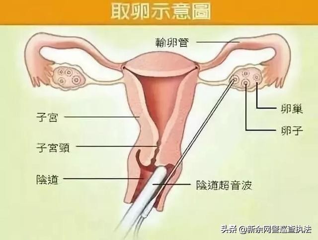 你卖卵吗？一次三万的那种