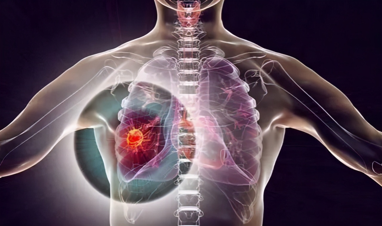 攻破癌细胞最好的机制,最快30分钟杀死癌细胞药物视频