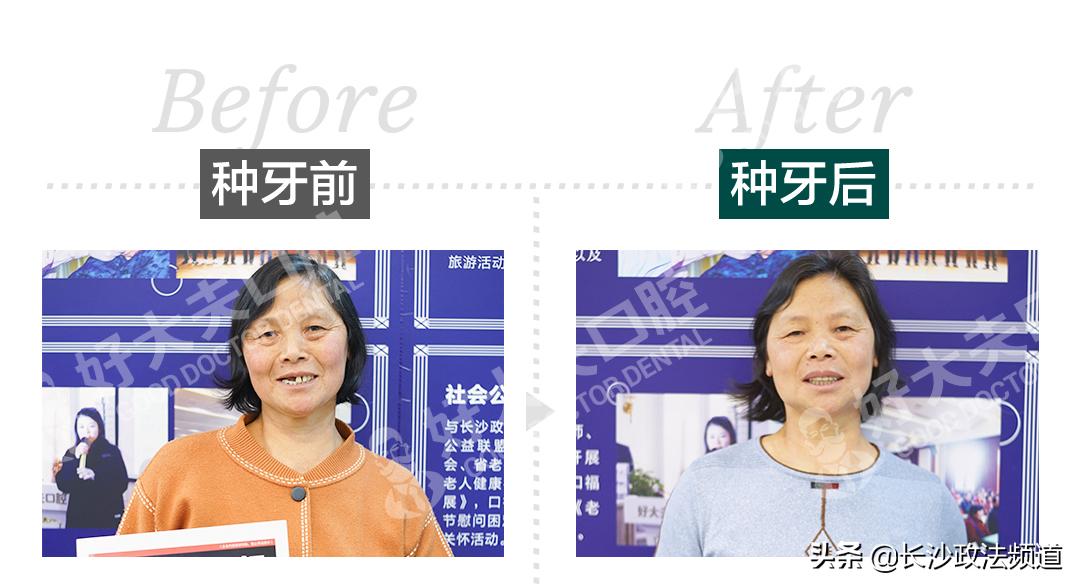 湖南人有消费券吗,湖南省2021看牙补贴政策是真的吗