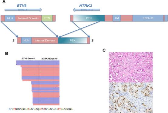 补雌激素能导致乳腺癌吗,女子花了千元买保健品