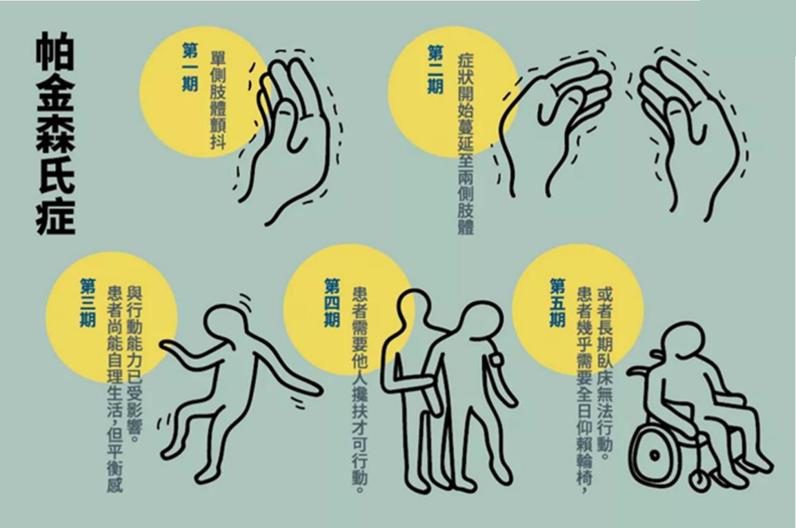 帕金森难题,攻克帕金森的最佳方法