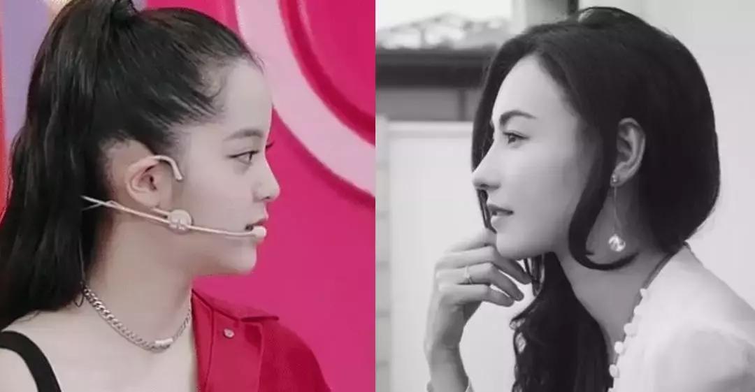 凹面型侧脸怎么改善,凹面型侧脸是怎么造成的