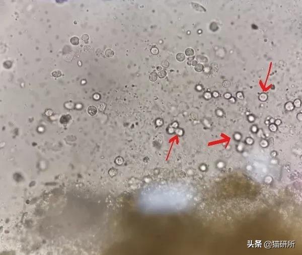 显微镜下的猫屎，竟然和这么多食物都撞脸？