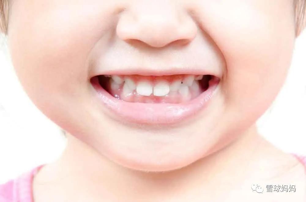 三岁孩子做根管治疗不配合,三岁小孩可以做根管治疗吗