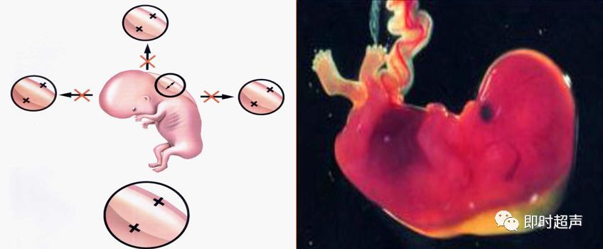 产科常规彩色超声报告单介绍,常见妇科疾病超声报告