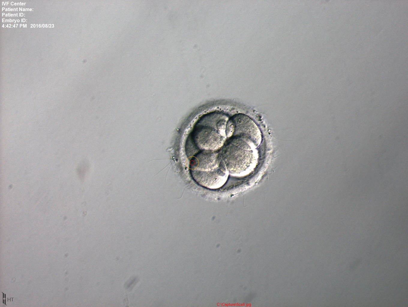 试管婴儿成功率怎么做才能提高,试管婴儿怎样提高成功率