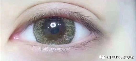 因为近视眼睛凸出来了怎么恢复,因为近视眼睛变得很凸怎样改善