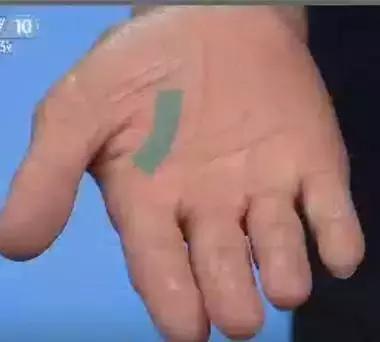 10种常见病对照表,100种常见病诊断