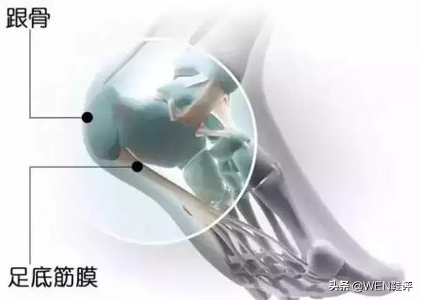 粉丝答疑：得足底筋膜炎和跟腱炎怎么办？为何对ZoomGP会有成见