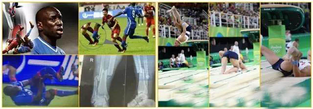 nba球员脚踝骨折恢复,nba篮球运动员脚踝撕脱性骨折