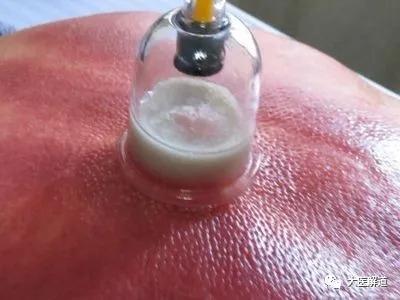 拔火罐利用了什么知识,拔火罐的技巧和手法视频