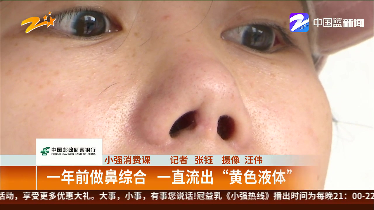 女子隆鼻手术出血,女性做鼻综合手术后的心态