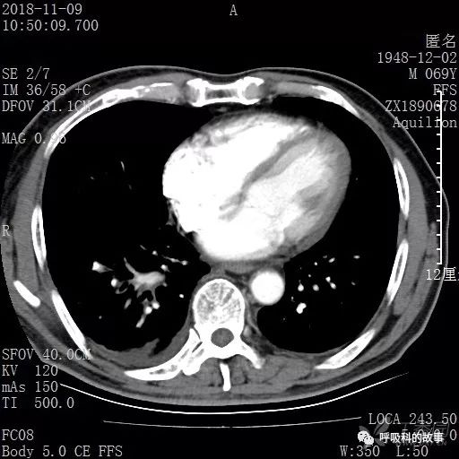 怎么应用统计学做调查,统计学方法可以解决的主要问题