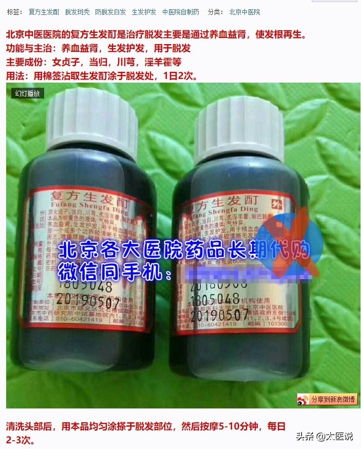 90后脱发大军日益壮大专家解释,90后进入脱发大军的特征