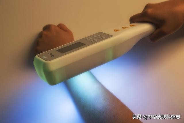 医院做一次皮肤病光疗多少钱,光疗治疗皮肤病有副作用吗