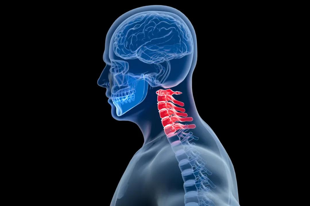 颈椎曲度变直能不能做手法复位,颈椎反曲科普视频