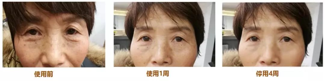 香港明星同款冻干面膜,各路明星推荐的面膜怎么样