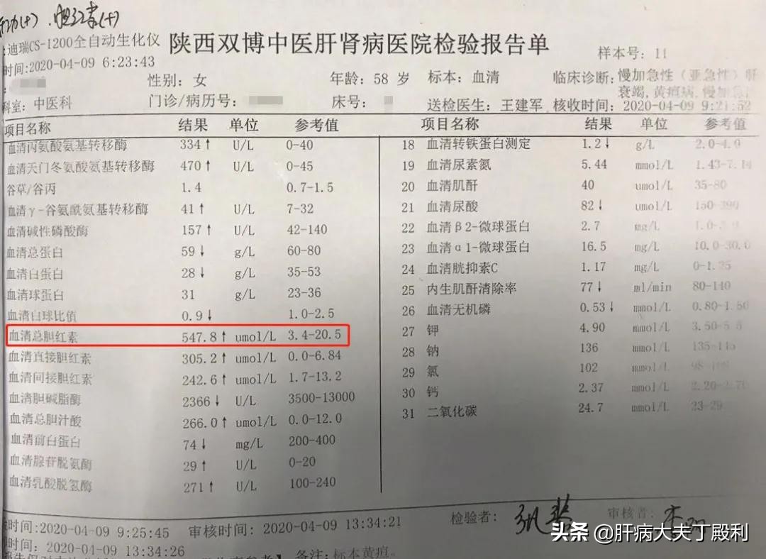 肝移植是治疗肝衰竭最好的手段,肝衰竭放弃肝移植