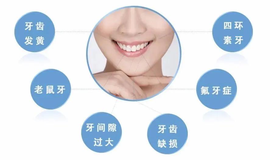 瓷贴面微笑的力量,局部瓷贴面