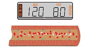 血管堵塞动态图片,血管疏通动图