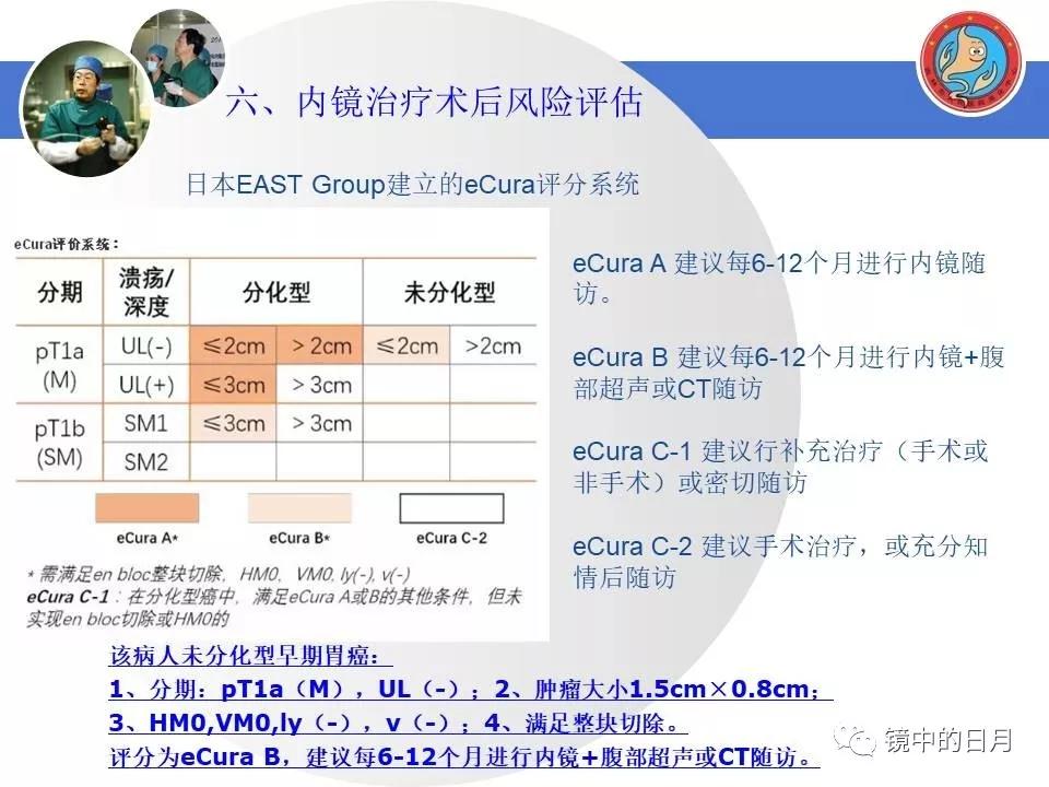 低分化胃癌早期时候做内镜手术吗,早期胃癌内镜手术后追加外科手术