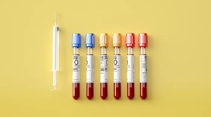 半夜口苦口臭是肝脏问题,口苦口臭舌苔发黄该做哪些检查